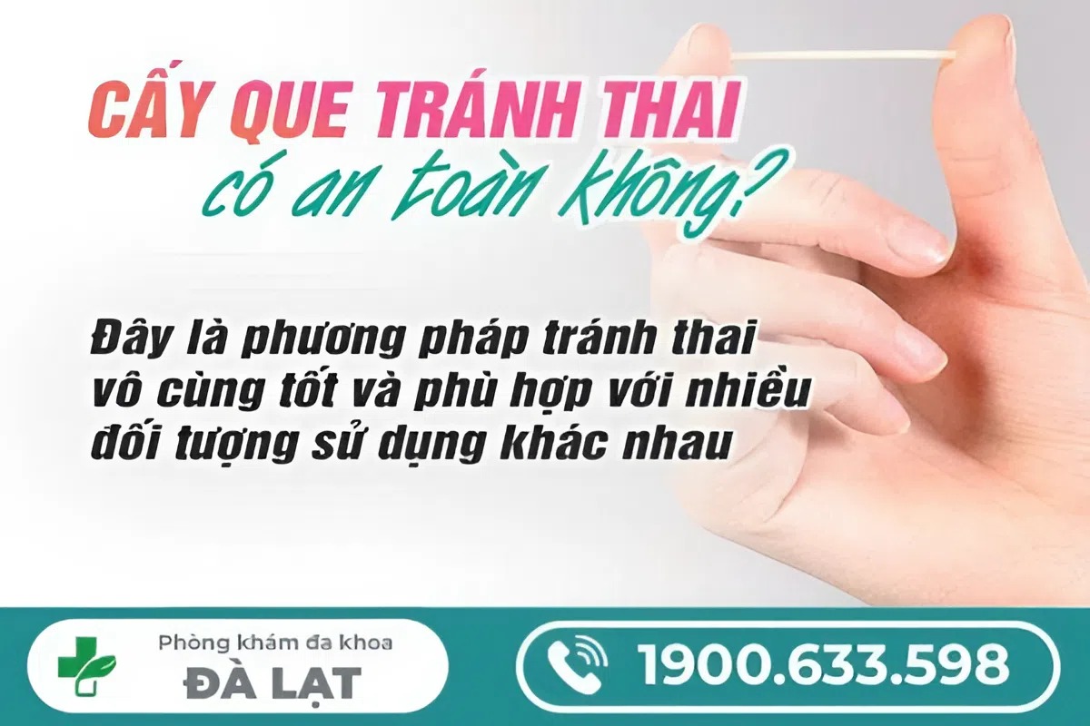 Hình ảnh minh họa